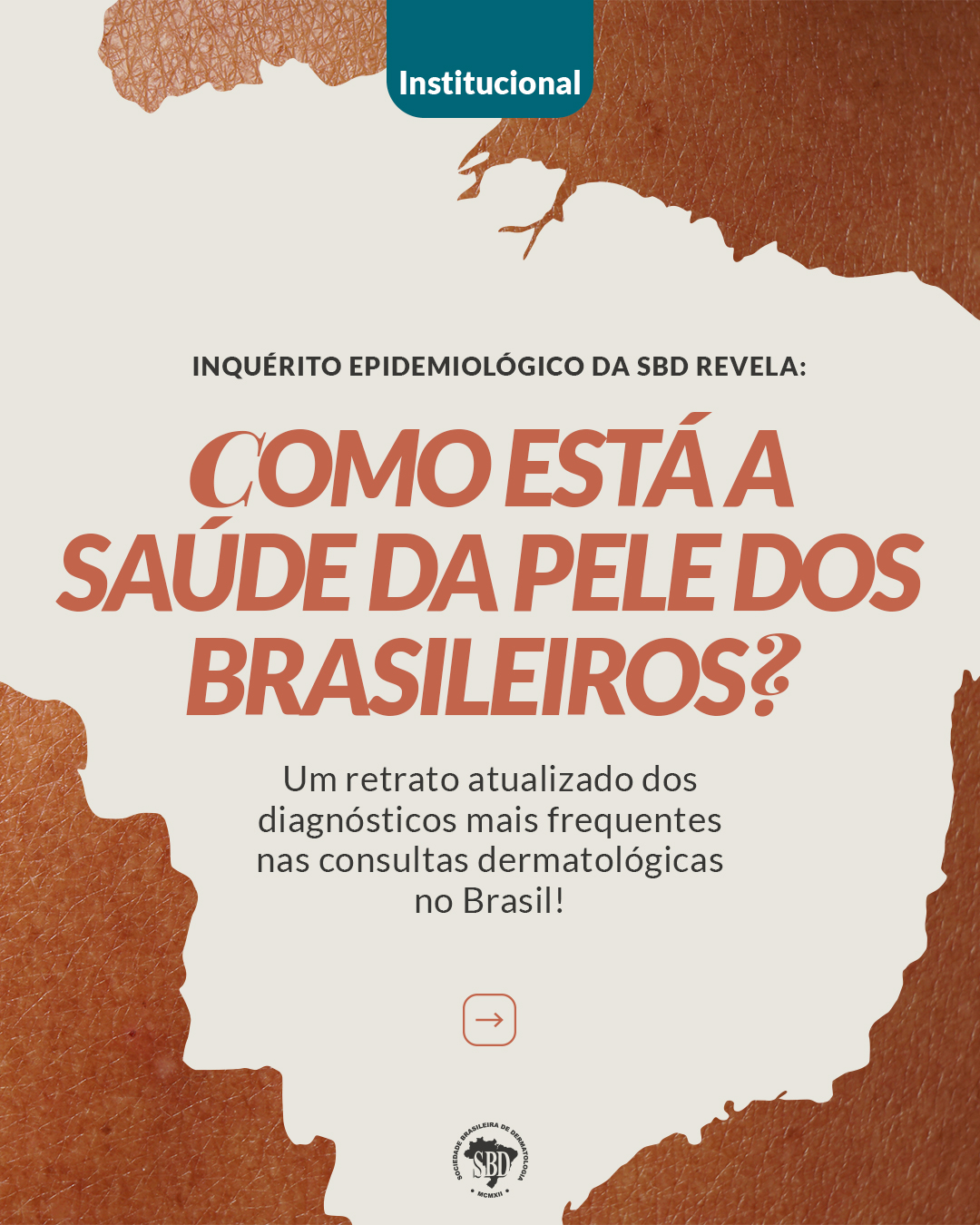Resultados do Inquérito Epidemiológico/Dermatológico da SBD 2024