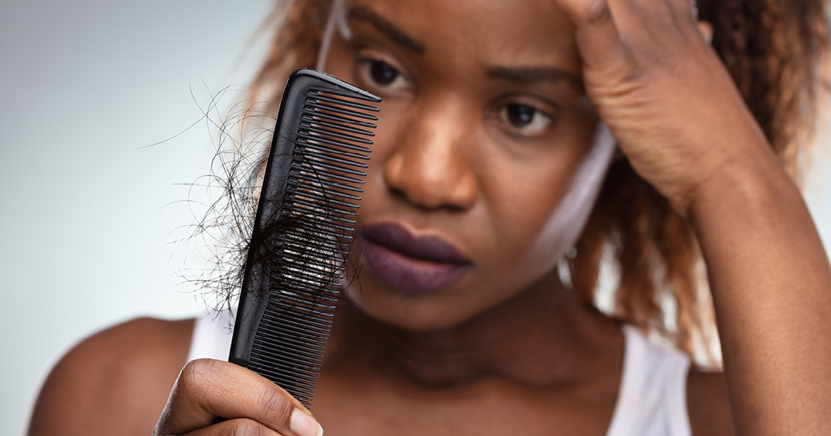 Metformina de baixa dose pode ajudar pacientes com alopecia cicatricial central